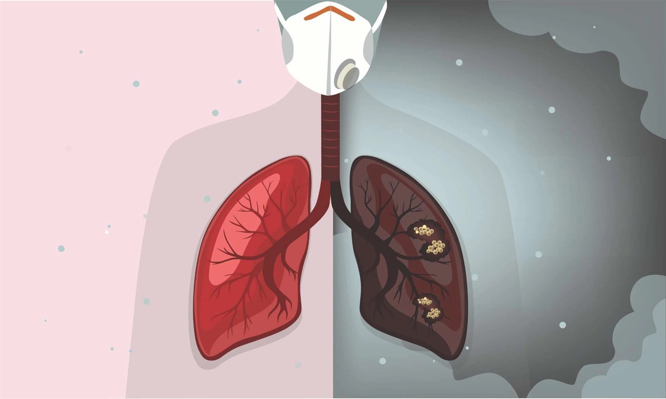 Ô nhiễm không khí ảnh hưởng đến sức khỏe