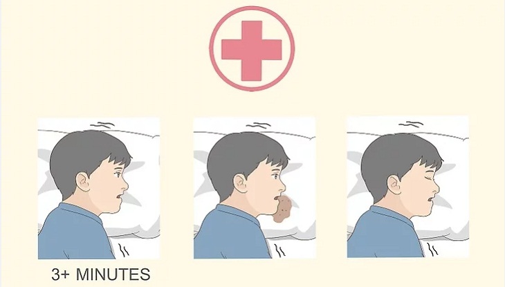 Cần đến cơ sở chăm sóc y tế ngay khi triệu chứng co giật kéo dài hơn 3 phút.