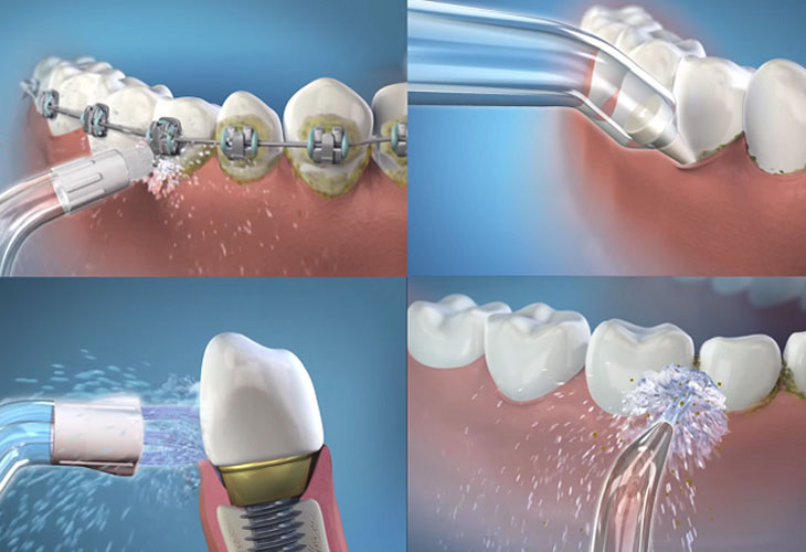 Các bước sử dụng tăm nước hiệu quả