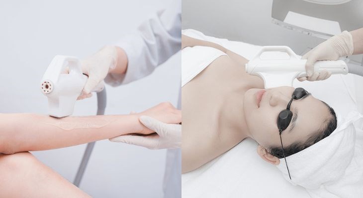 Công nghệ IPL có thể sử dụng cho nhiều vùng da khác nhau, tạo sự thuận tiện cho bạn trong quá trình sử dụng