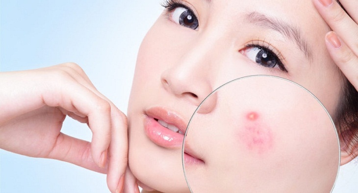 Mụn viêm, mụn mủ không nên sử dụng máy massage mặt