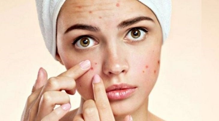 Lạm dụng máy rửa mặt sẽ gây ảnh hưởng đến làn da