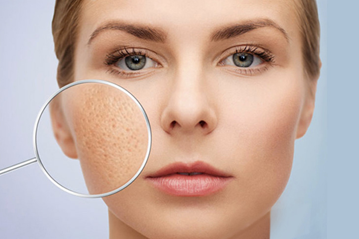 Gel có công dụng ngăn ngừa sẹo hiệu quả