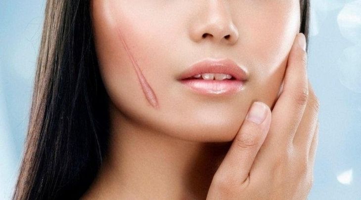 Massage mặt giúp hỗ trợ quá trình liền sẹo