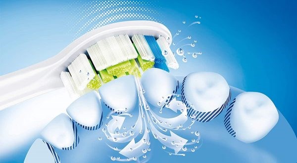 Công nghệ siêu sóng âm vừa có khả năng làm sạch răng miệng hiệu quả vừa không gây ồn trong khi hoạt động