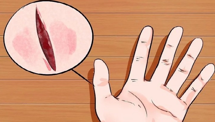 Không sử dụng máy massage xung điện ở khu vực có vết thương hở