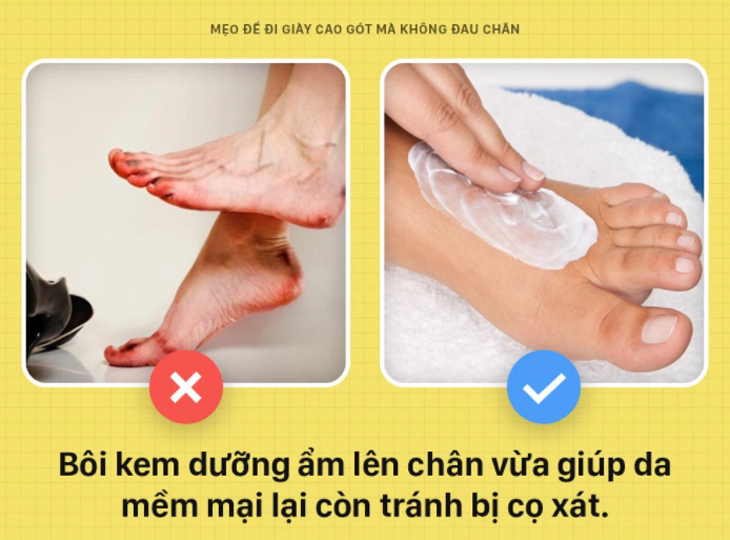 Kem dưỡng ẩm giảm việc đau chân ở mũi giày và gót giày