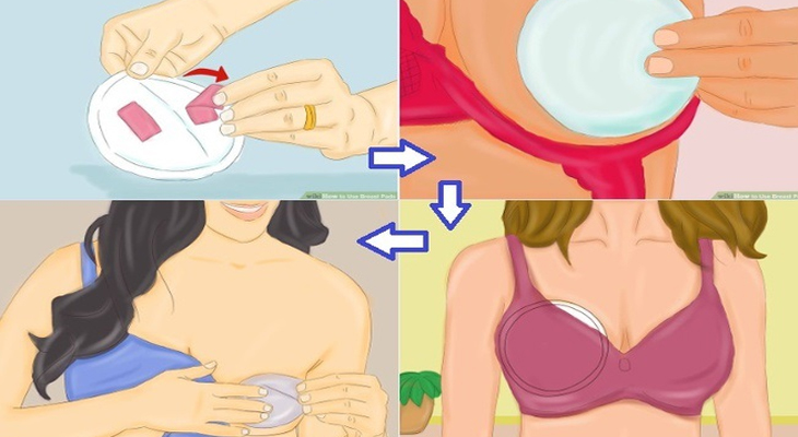 Hỗ trợ cố định đầu ngực