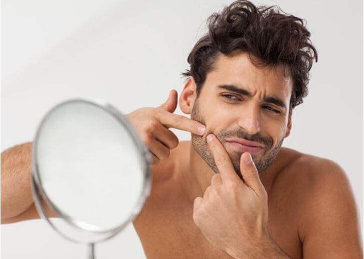 Vệ sinh da mặt không đúng cách làm cho tình trạng mụn đầu đen ngày càng nặng