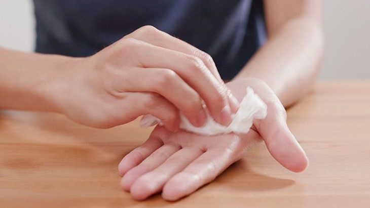 Các bệnh lý gây tiết mồ hôi