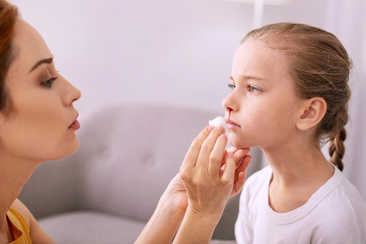 Không nên nằm hoặc ngả đầu ra sau khi chảy máu cam
