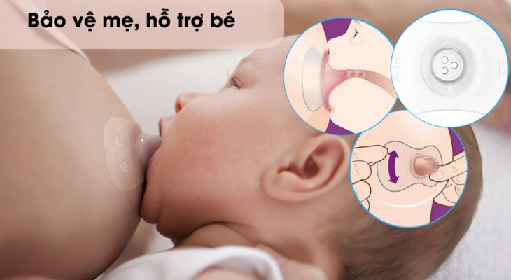 Dùng núm trợ ti phù hợp cho bé gặp khó khăn khi ngậm ti sữa và giúp mẹ giảm bớt cơn đau đầu ti