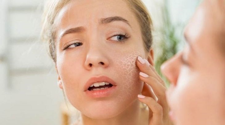Lạm dụng máy rửa mặt da sẽ gây khô, nổi mẩn đỏ và ngứa da